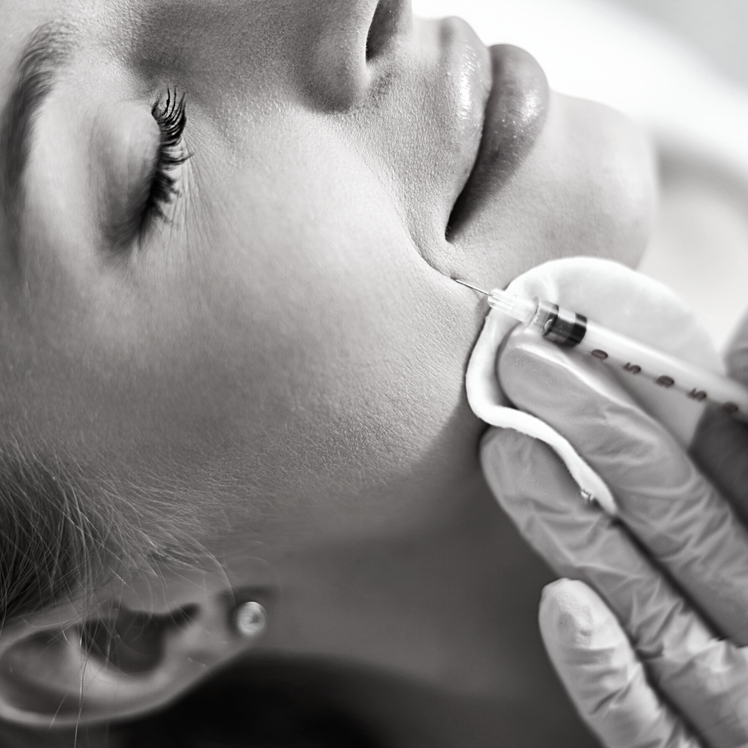 Comment attenuer les rides du sillon nasogénien ?