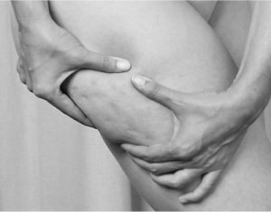 traitement peau d'orange cellulite Clinique Crillon Lyon