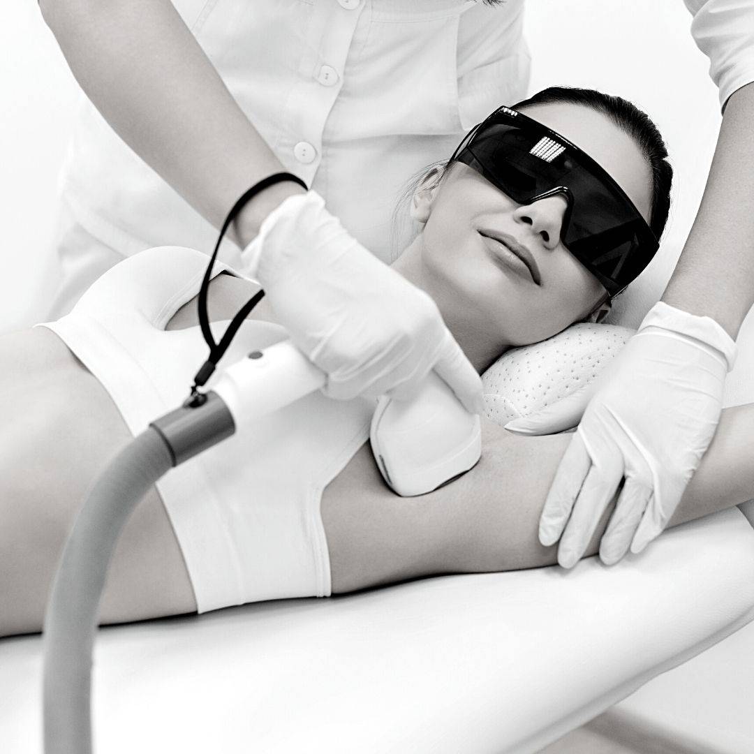 Epilation définitive : laser ou lumière pulsée, que choisir ?